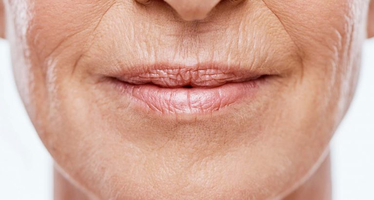 Skin Boosters